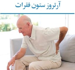 آرتروز2-min-256x240