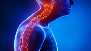 اصلاح قوس پشت مهره های گردن ناشی از نحوه نشستن و ایستادن اشتباه