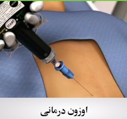 اوزون1-1-min-256x240