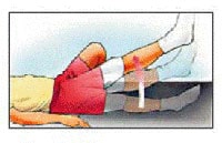حرکات اصلاحی و ورزش بعد از عمل آرتروسکوپی