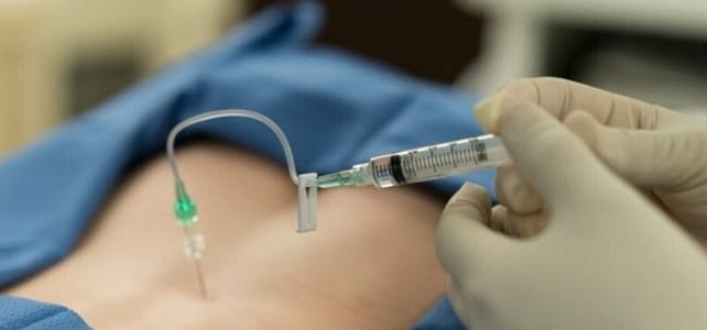 درمان بیرون زدگی دیسک کمر با تزریق استروئید اپیدورال