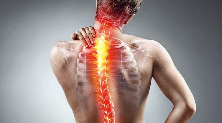 سایر علل درد در بخش فوقانی کمر