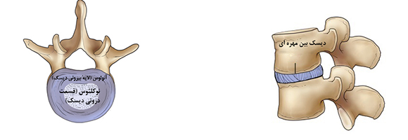 دیسک های بین مهره ای