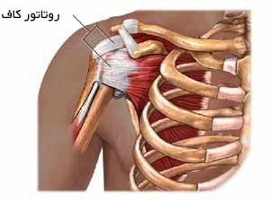 پارگی روتاتور کاف شانه